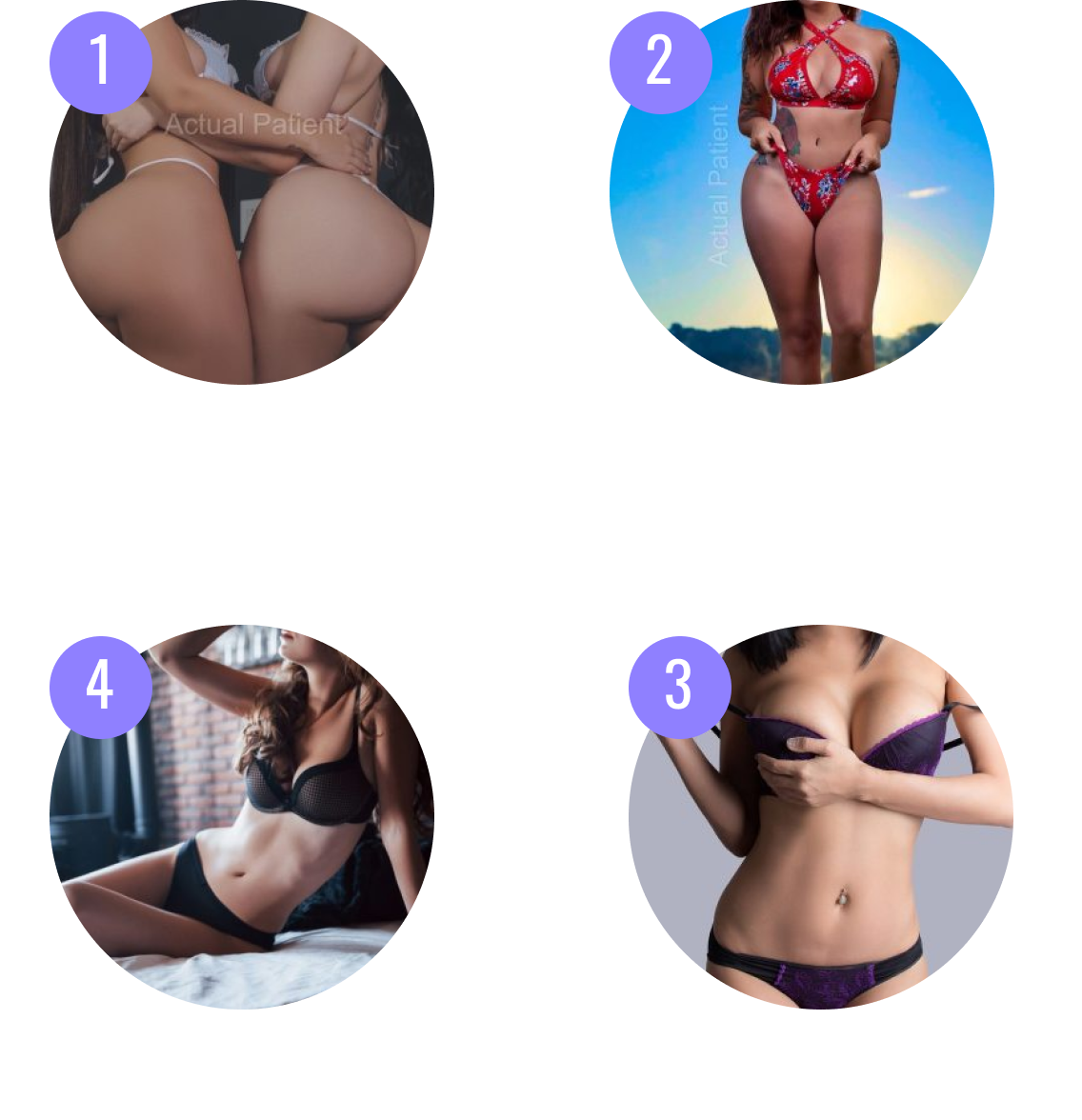 Tummy tuck before and after